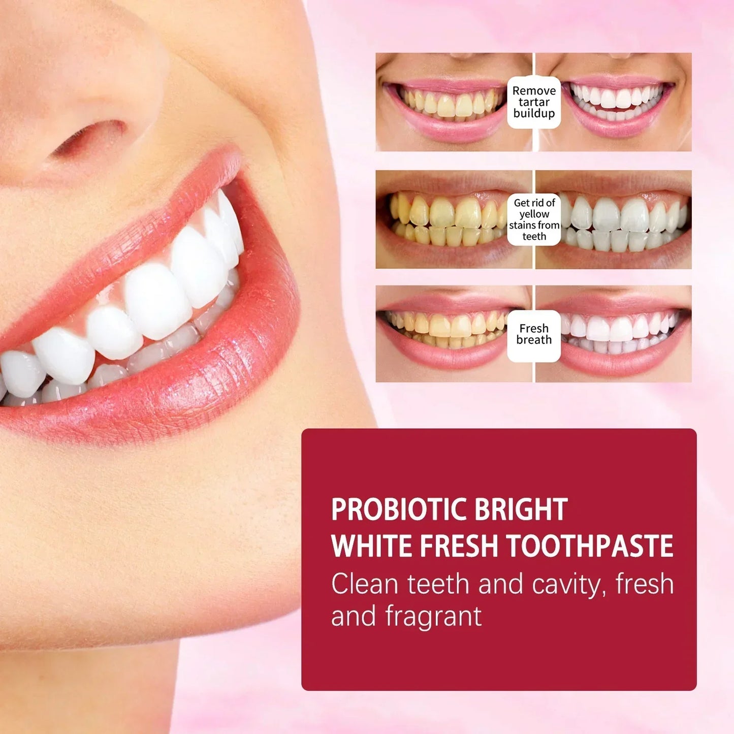 Yayashi SP4 Probiotic Whitening Toothpaste 120g